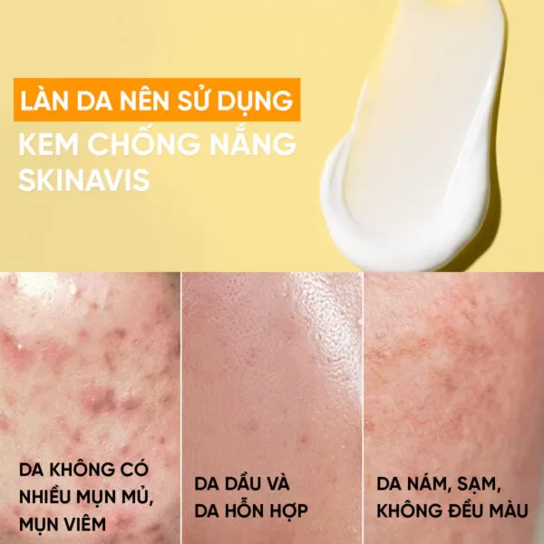Kem chống nắng Skinavis defense – Phổ rộng, không lên tone da